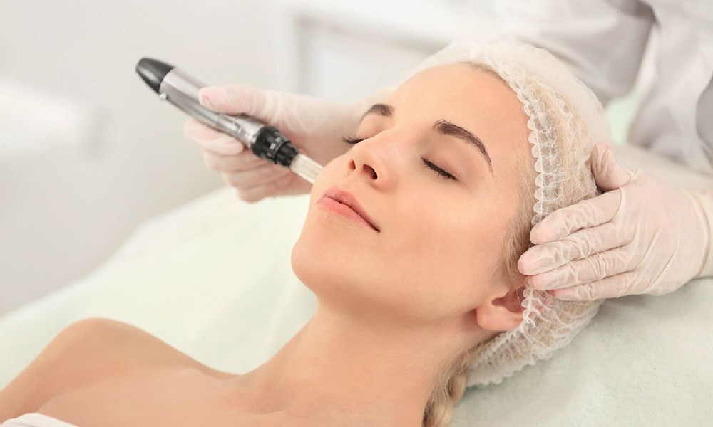 Automated microneedling