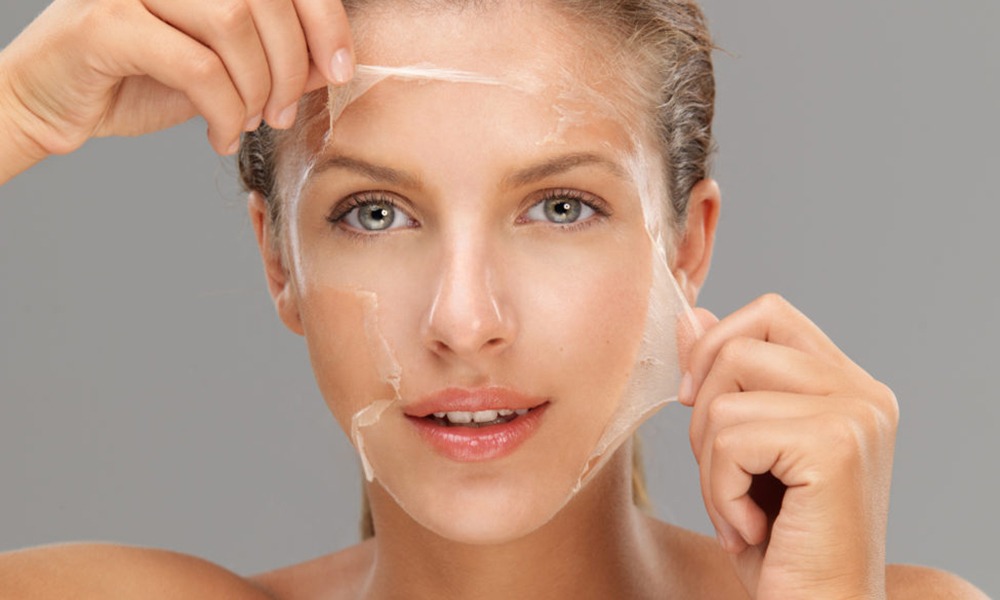 Facial Peels