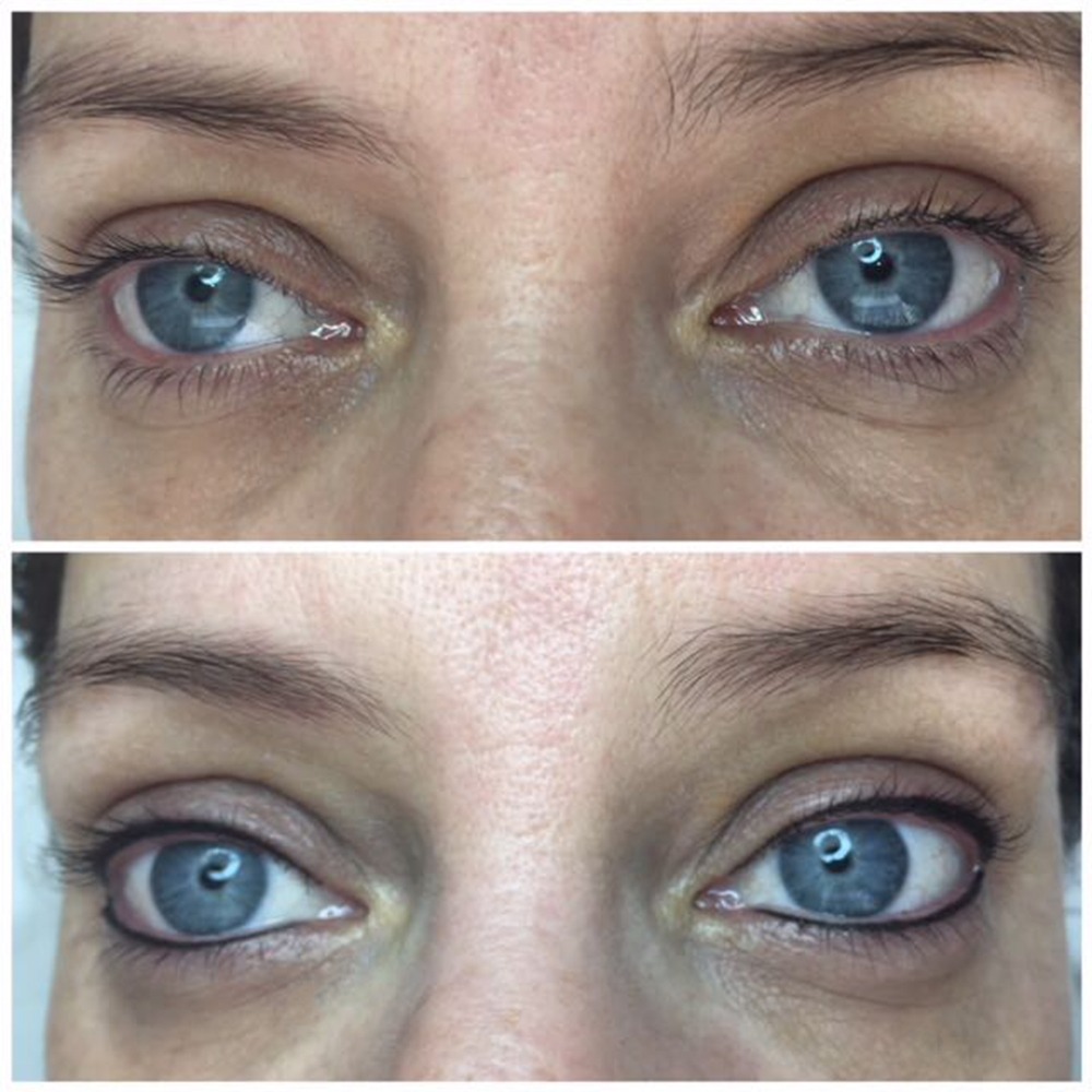 Permanent Eyeliner