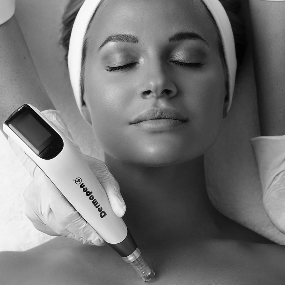 Black and white thumbnail image of Dermapen 4 MD micro-needling treatment.
