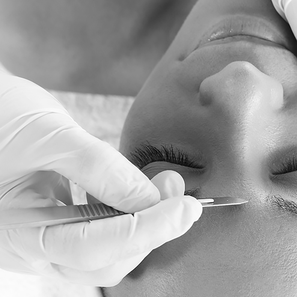 Black and white thumbnail image of Dermaplane Pro skin exfoliation treatment.