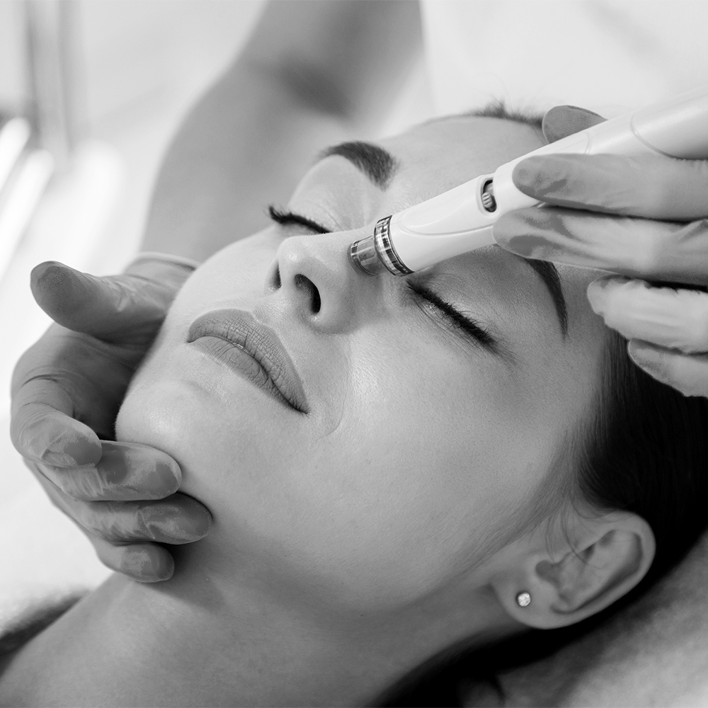 Black and white thumbnail image of Pepita Microdermabrasion, a skin exfoliation treatment.