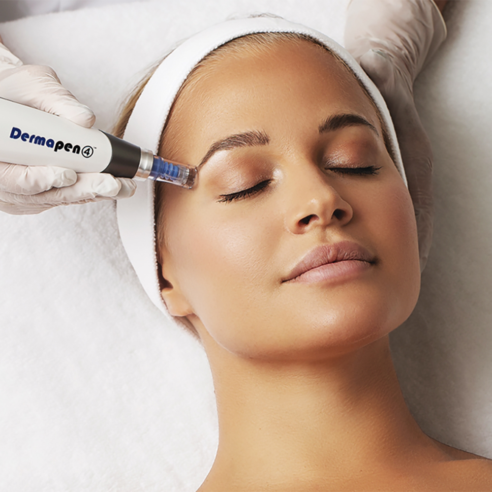 Patient with a relaxed expression receiving the Dermapen 4™ MD microneedling treatment.